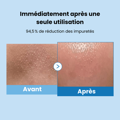 Huile Nettoyante Visage Anti - Pores & Sébum - Lumiaglow